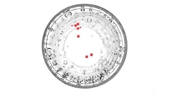 Als u symptomen van prostatitis heeft, moet u worden getest op verborgen infecties.